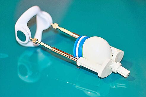 Genişletici - Bir üyede etkili bir artış için bir cihaz